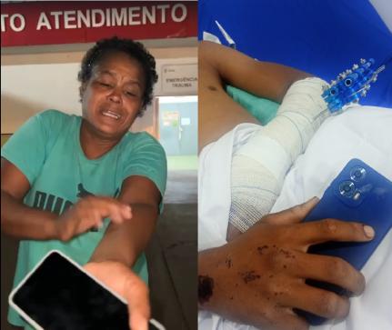 Jovem sente algo e vê larvas saindo do ferimento do braço